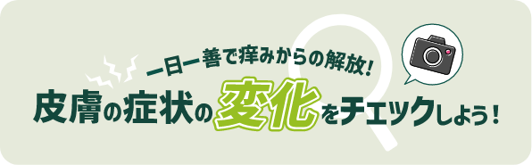 一日一善で痒みからの解放！皮膚の症状の変化をチェックしよう！