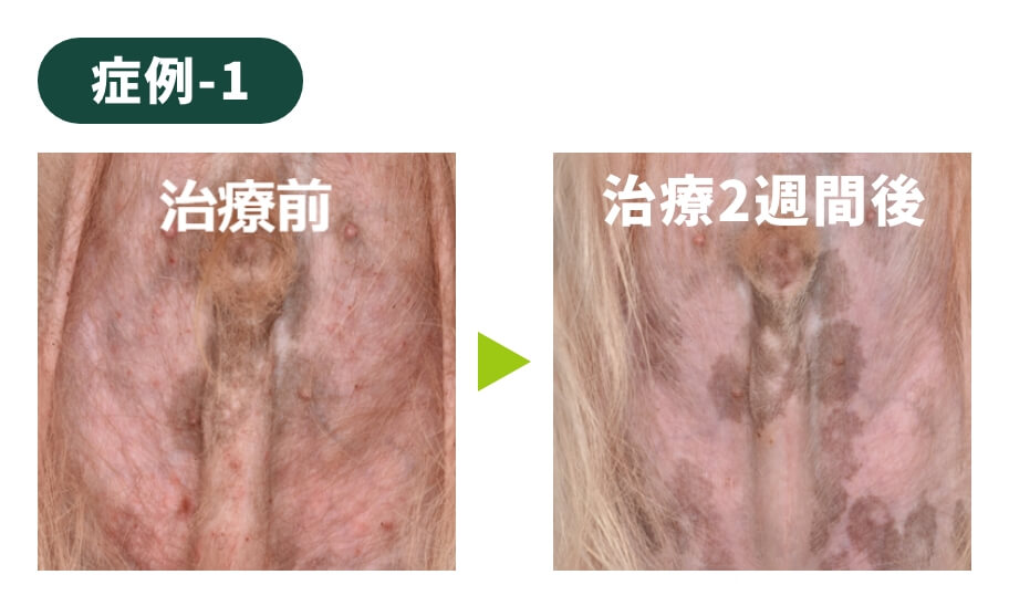 症例-1