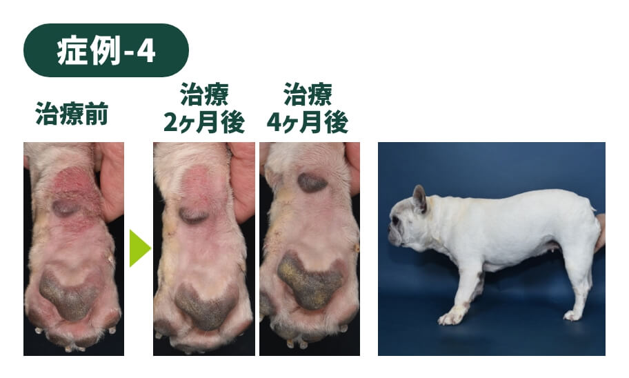 症例-4