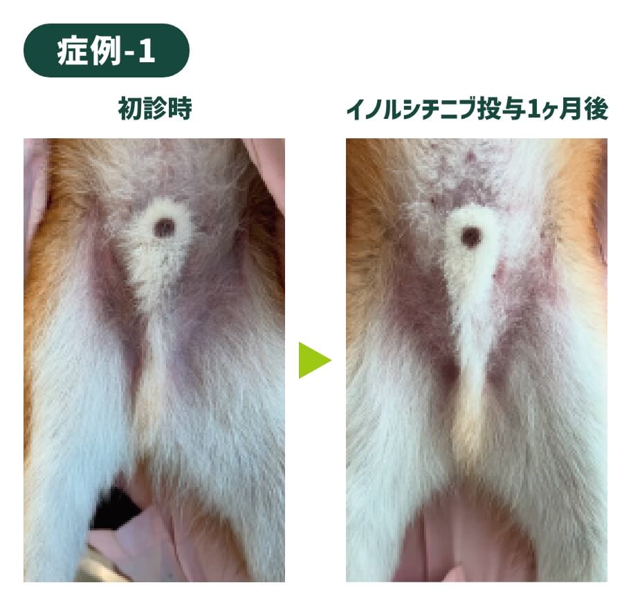 症例-1