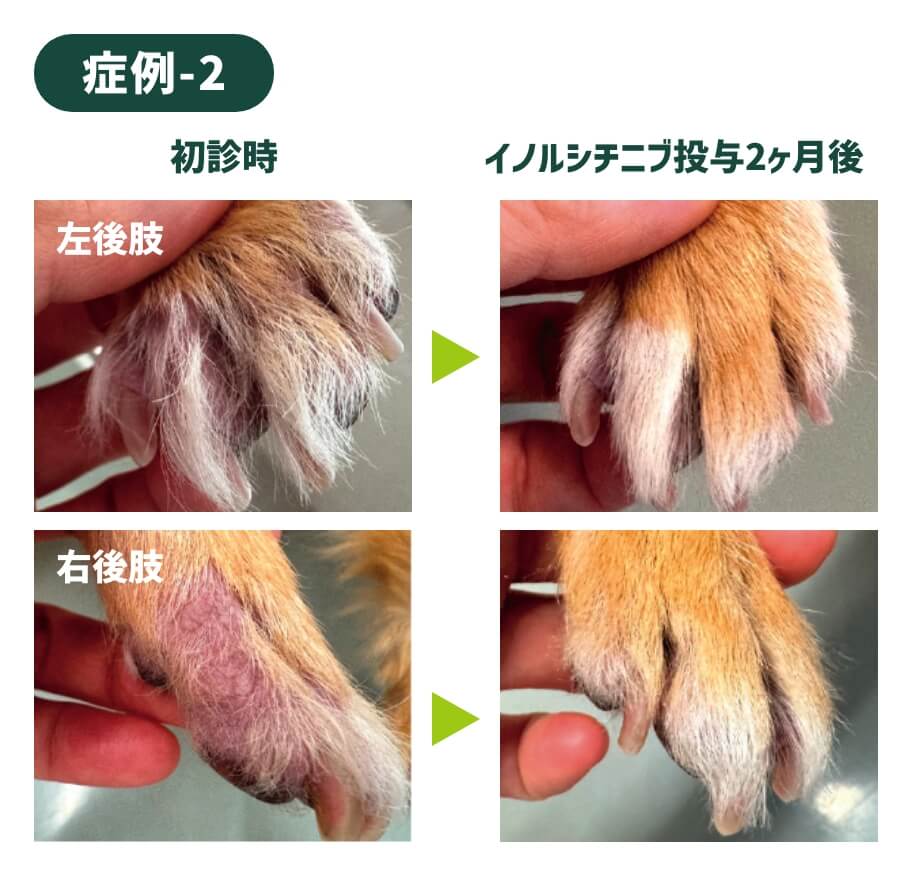 症例-2