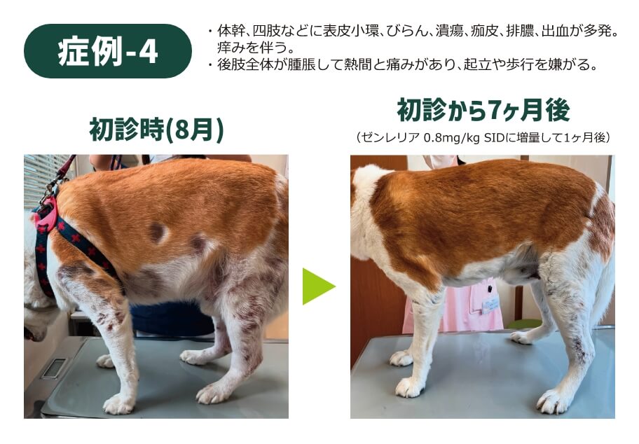 症例-4