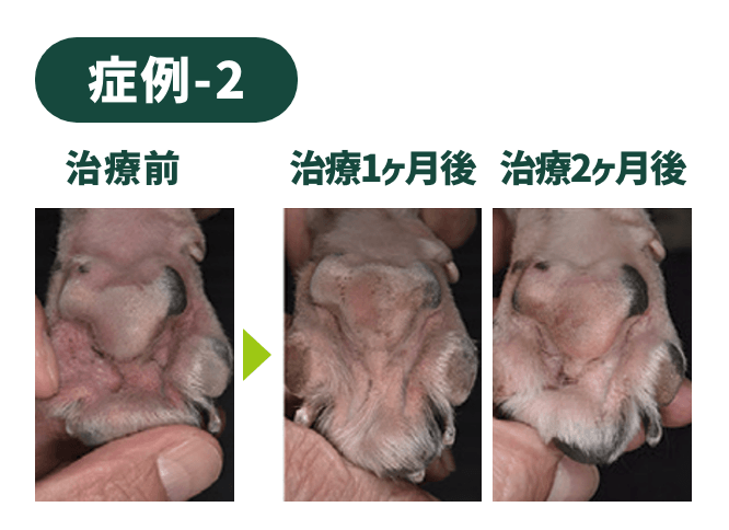 症例-2