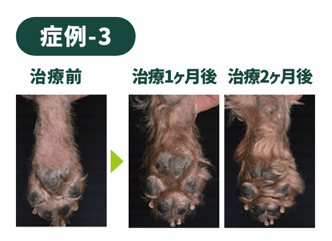 症例-3