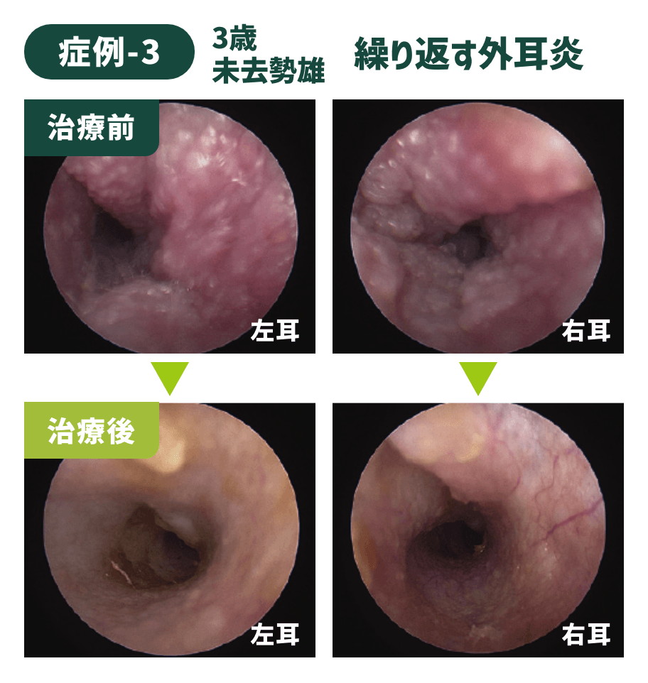 症例-3
