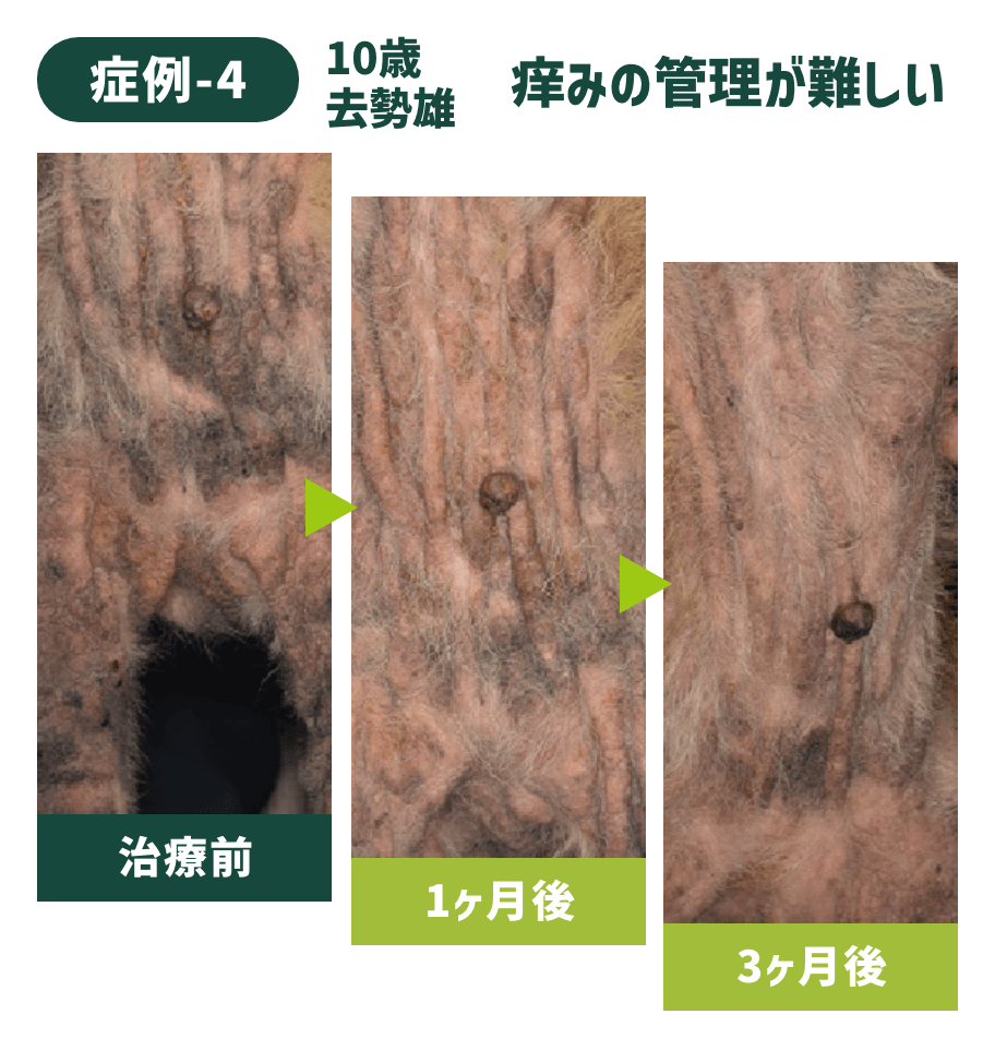 症例-4