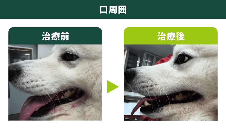 口周囲