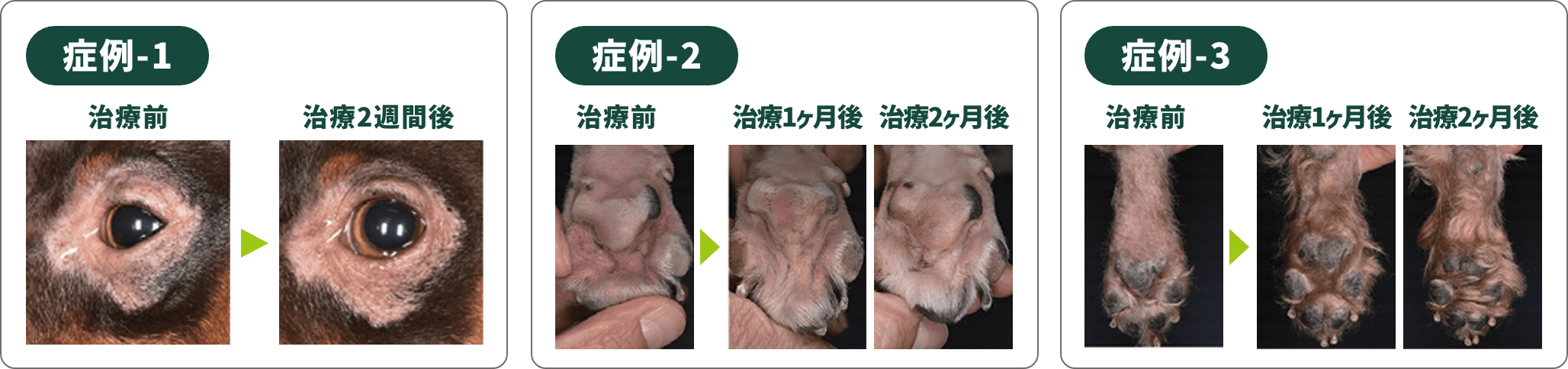 症例